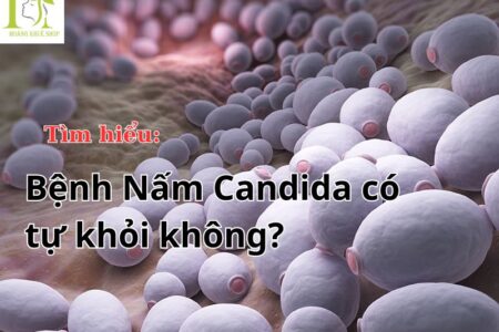 Bệnh nấm candida có tự khỏi không?