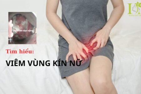 Viêm vùng kín nữ