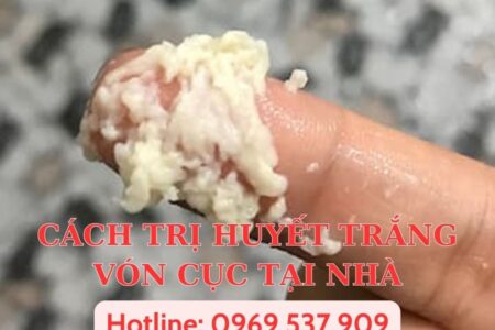 CÁCH TRỊ HUYẾT TRẮNG VÓN CỤC TẠI NHÀ