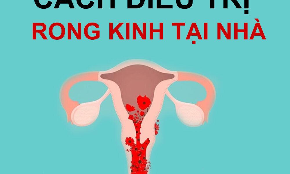 CÁCH ĐIỀU TRỊ RONG KINH TẠI NHÀ