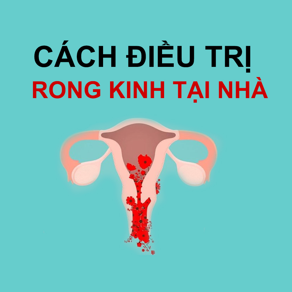 CÁCH ĐIỀU TRỊ RONG KINH TẠI NHÀ