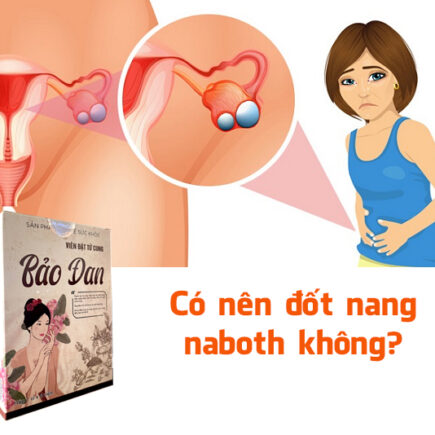 có nên đốt nang naboth không