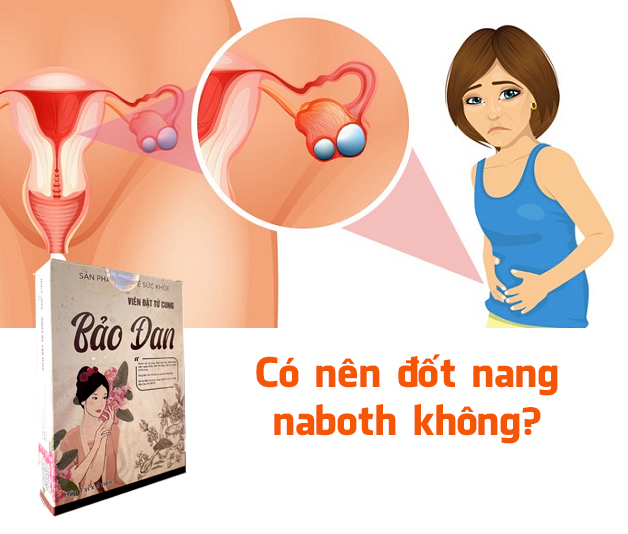 có nên đốt nang naboth không