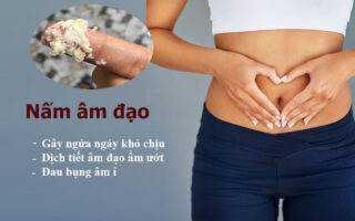 viêm nấm âm đạo