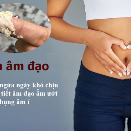 viêm nấm âm đạo