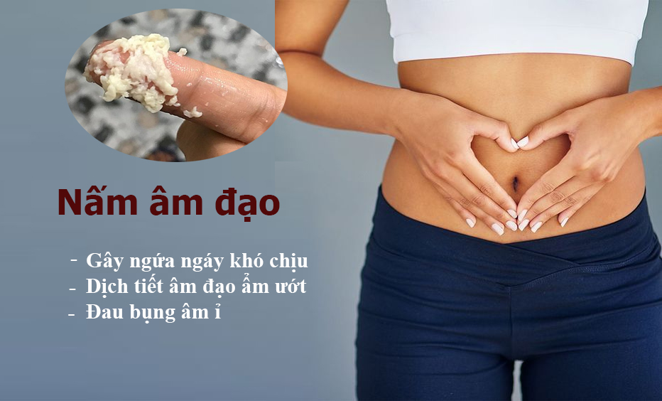 viêm nấm âm đạo