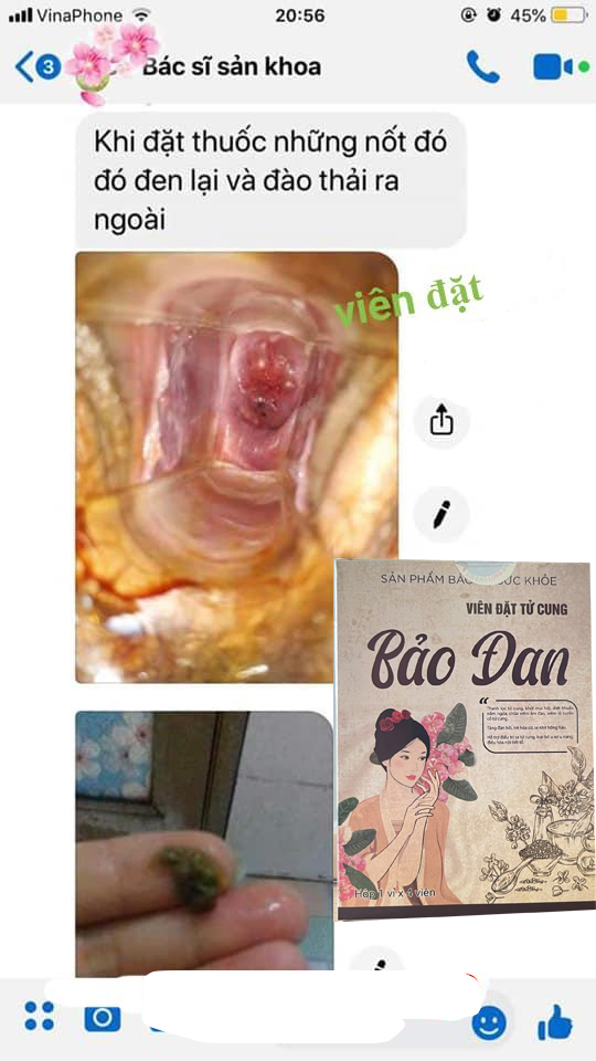 Chữa nang naboth bằng thuốc nam