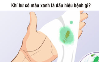 Khí hư màu xanh