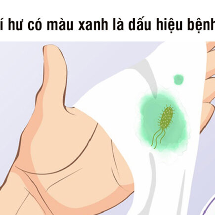 Khí hư màu xanh