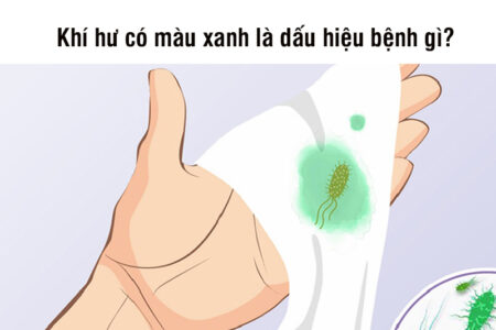 Khí hư màu xanh