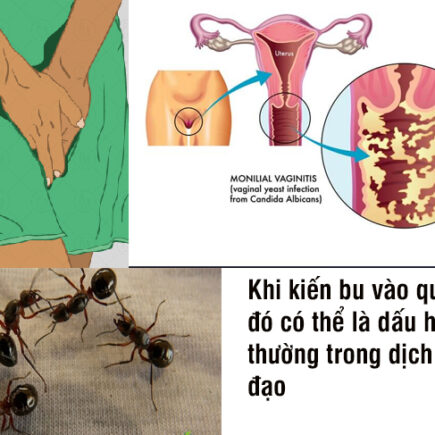 quần lót bị kiến bu