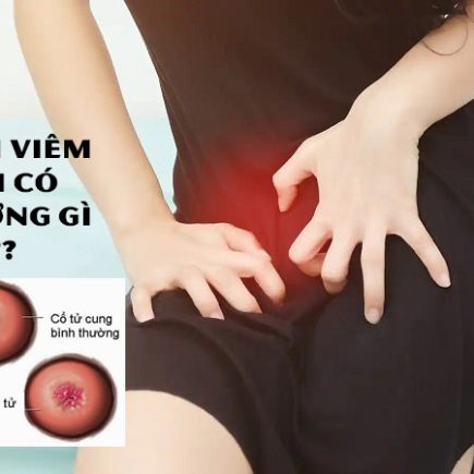 Đốt Điện Viêm Lộ Tuyến Có Ảnh Hưởng Gì Không